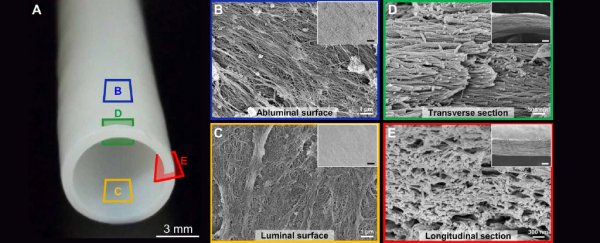 Hav Vessel Cadaver 600