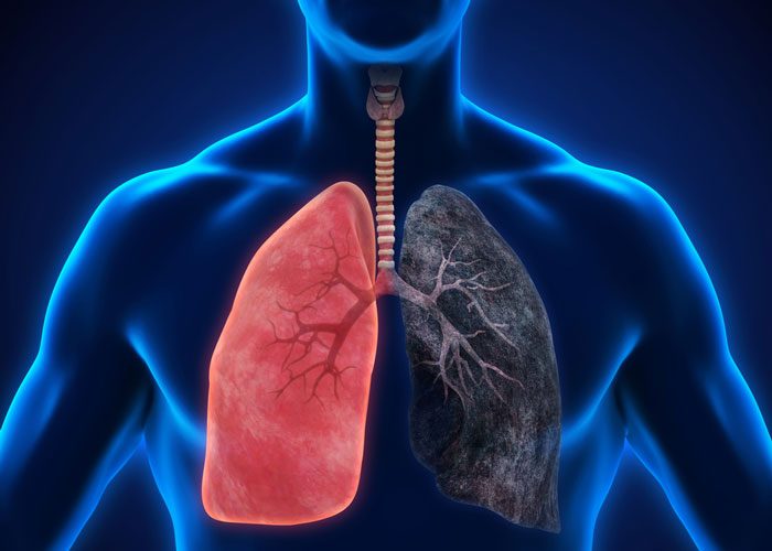 Shutterstock 606112508 Lungs 700x500