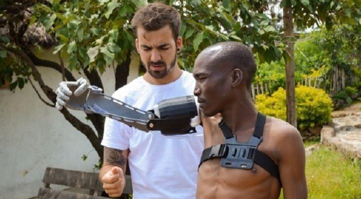 A Engineer Builds Free Prosthetics For The Poor An