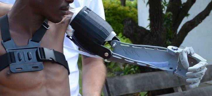 A Engineer Builds Free Prosthetics For The Poor An