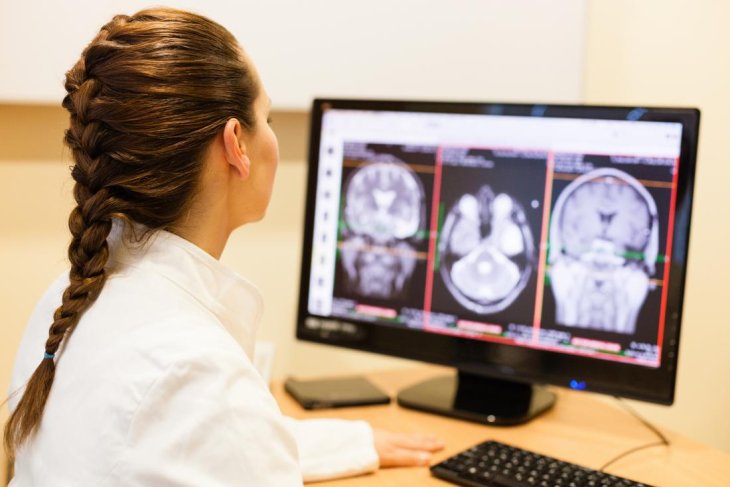 A Female Doctor Analyzing Mri Scan Of A Brain Aneu