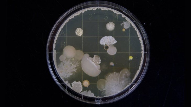 Bacteria-bombs-detection