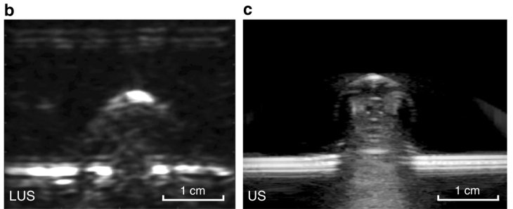a-new-laser-based-system-can-look-inside-your-body-without-you-knowing-3