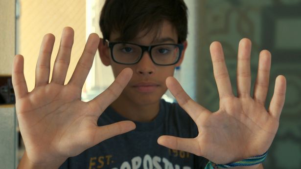 having-a-sixth-finger-turns-out-to-be-an-advantage-1