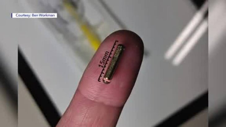 man-implants-chips-in-his-hand