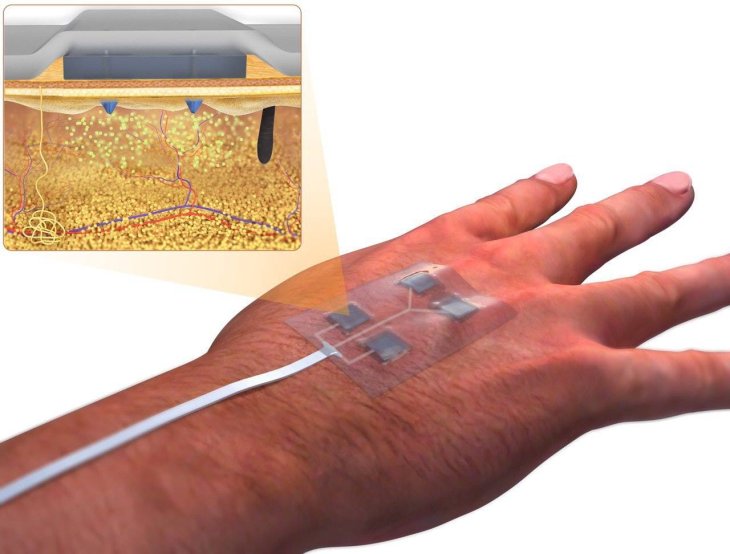 Smart Bandage Will Heal Wounds That Can't Heal