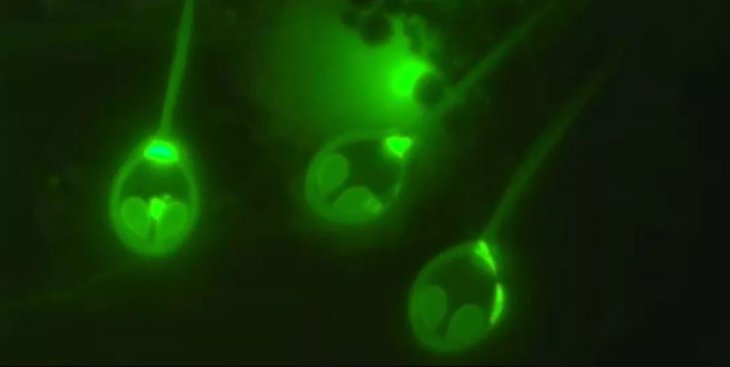 Henneguya salminicola