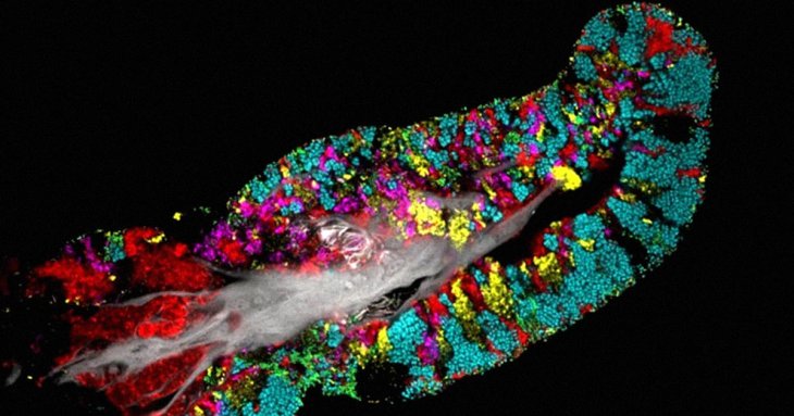 Bacteria Colonize Tongue