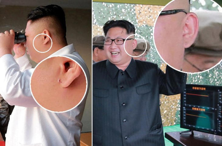 Kim Jong Un Ear Lobes