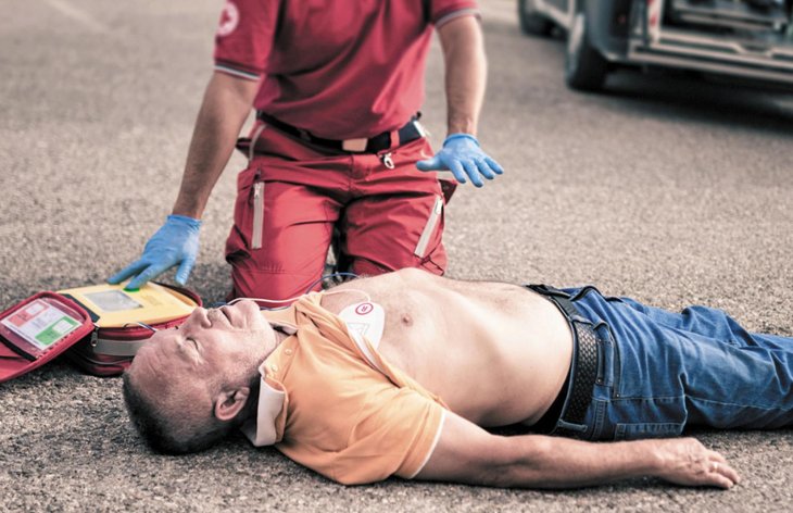 Cardiac Arrest