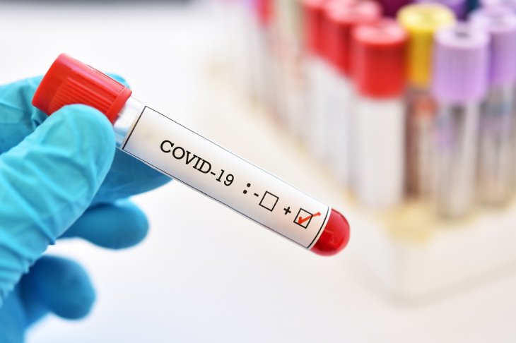 Covid 19 Test Positive